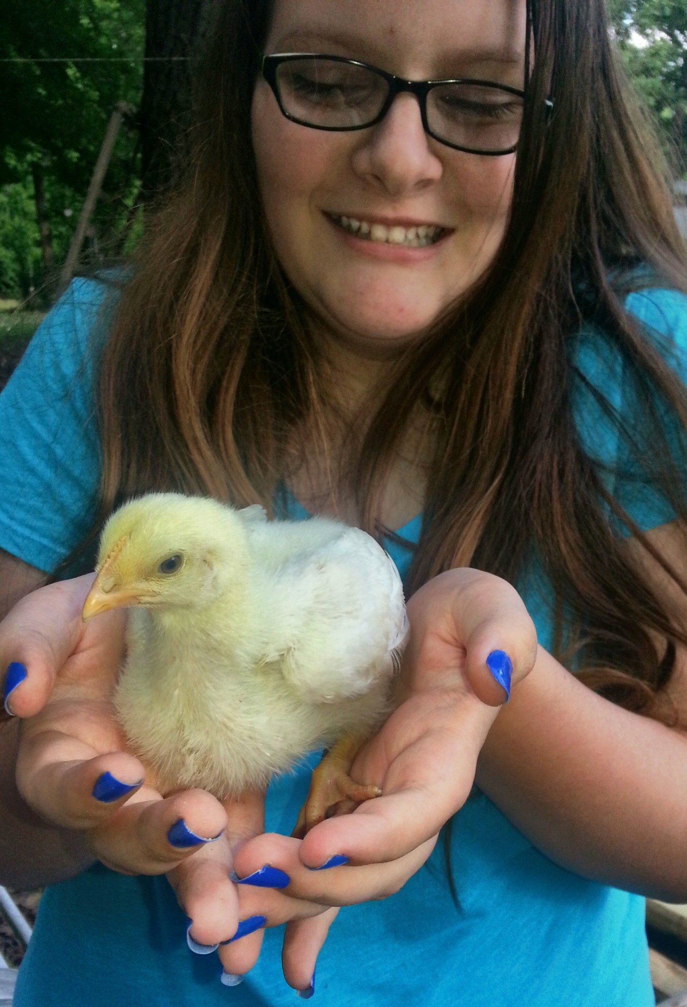 Backyard Chickens Learn How To Raise Chickens 